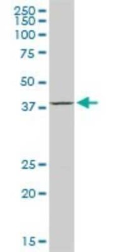 ACAA2 Antibody (2F7), Novus Biologicals 0.1 mg | Buy Online | Novus Biologicals | Fisher Scientific