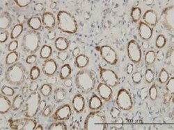 ACAA2 Antibody (5C4), Novus Biologicals 0.1 mg; Unconjugated:Antibodies,