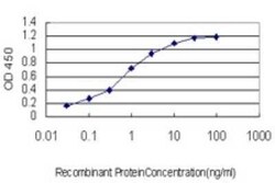 ACAA2 Antibody (5C4), Novus Biologicals 0.1 mg; Unconjugated:Antibodies,