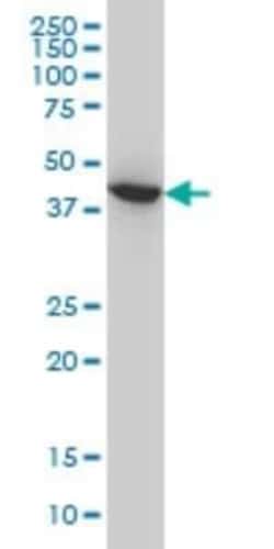 ACAA2 Antibody (5C4), Novus Biologicals 0.1 mg; Unconjugated:Antibodies,