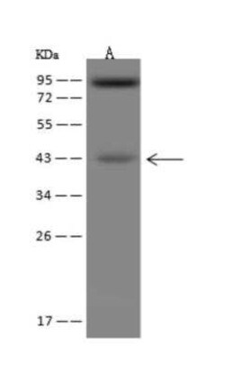 ACAA2 Antibody, Novus Biologicals:Antibodies:Primary Antibodies