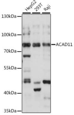 ACAD11 Antibody - Azide and BSA Free, Novus Biologicals 0.1 mL, Unconjugated:Antibodies,
