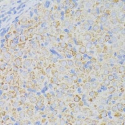 ACADL Antibody - BSA Free, Novus Biologicals 0.02 mL, Unconjugated:Antibodies,