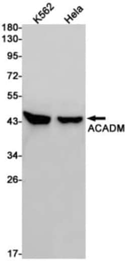 ACADM Antibody (S06-8F7), Novus Biologicals:Antibodies:Primary Antibodies