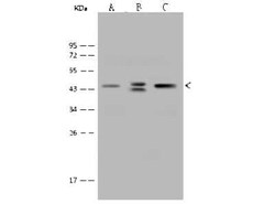 ACADS Antibody, Novus Biologicals:Antibodies:Primary Antibodies