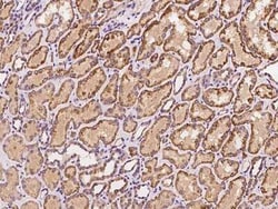 ACADSB Antibody, Novus Biologicals 50 &mu;g, Unconjugated:Antibodies, Polyclonal