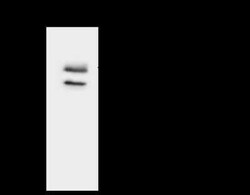 ACADSB Antibody, Novus Biologicals 50 &mu;g, Unconjugated:Antibodies, Polyclonal