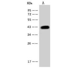 ACADSB Antibody, Novus Biologicals 50 &mu;g, Unconjugated:Antibodies, Polyclonal