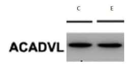 ACADVL Antibody (5D3), Novus Biologicals 0.1 mg, Unconjugated:Antibodies,