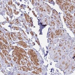 ACAP4 Antibody, Novus Biologicals:Antibodies:Primary Antibodies