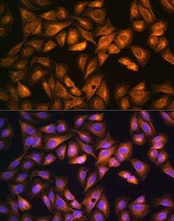 SOAT1 Antibody - BSA Free, Novus Biologicals:Antibodies:Primary Antibodies