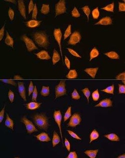 SOAT1 Antibody - BSA Free, Novus Biologicals:Antibodies:Primary Antibodies