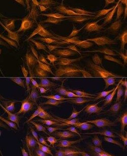 SOAT1 Antibody - BSA Free, Novus Biologicals:Antibodies:Primary Antibodies