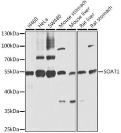 SOAT1 Antibody - BSA Free, Novus Biologicals:Antibodies:Primary Antibodies