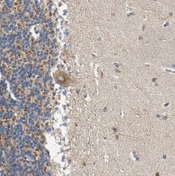 ACAT1 Antibody, Novus Biologicals 0.1 mL; Unconjugated:Antibodies, Polyclonal