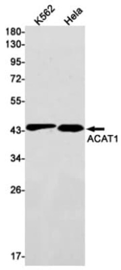 ACAT1 Antibody (S02-5G8), Novus Biologicals 50 &mu;g | Buy Online | Novus Biologicals | Fisher Scientific