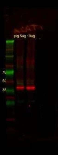 ACAT1 Antibody, Novus Biologicals 0.1 mL; Unconjugated:Antibodies, Polyclonal