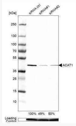 ACAT1 Antibody, Novus Biologicals 0.1 mL; Unconjugated:Antibodies, Polyclonal