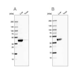 ACAT1 Antibody, Novus Biologicals 0.1 mL; Unconjugated:Antibodies, Polyclonal