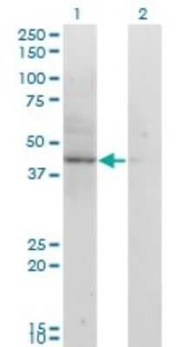 ACAT2 Antibody (4A5), Novus Biologicals 0.1 mg | Buy Online | Novus Biologicals | Fisher Scientific