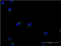 ACBD3 Antibody (2H2), Novus Biologicals 0.1 mg; Unconjugated:Antibodies,