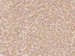 ACBD5 Antibody, Novus Biologicals:Antibodies:Primary Antibodies