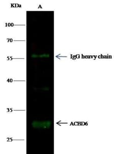 ACBD6 Antibody (4A9D5E9), Novus Biologicals 50 &mu;g; Unconjugated:Antibodies,