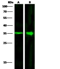 ACBD6 Antibody (4A9D5E9), Novus Biologicals 50 &mu;g; Unconjugated:Antibodies,