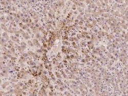 ACBD6 Antibody, Novus Biologicals 100 &mu;g, Unconjugated:Antibodies, Polyclonal