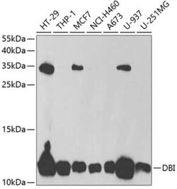 ACBP Antibody - BSA Free, Novus Biologicals 0.02 mL, Unconjugated:Antibodies,