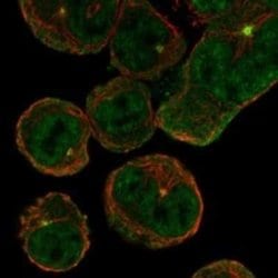 ACCN4 Rabbit anti-Human, Polyclonal, Novus Biologicals 100 &mu;g | Buy Online | Novus Biologicals | Fisher Scientific