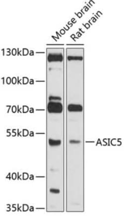 ACCN5 Antibody - BSA Free, Novus Biologicals 0.02 mL | Buy Online | Novus Biologicals | Fisher Scientific