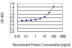 ACD Antibody (1D8-1B6), Novus Biologicals 0.1 mg; Unconjugated:Antibodies,