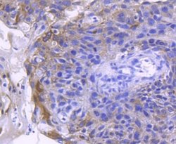 ACE-2 Antibody (SN0754), Novus Biologicals 100&mu;L:Antibodies, Monoclonal
