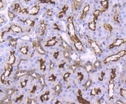 ACE-2 Antibody (SN0754), Novus Biologicals 100&mu;L:Antibodies, Monoclonal