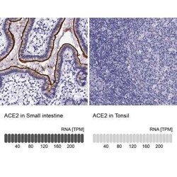 ACE-2 Antibody, Novus Biologicals 0.1 mL | Buy Online | Novus Biologicals | Fisher Scientific