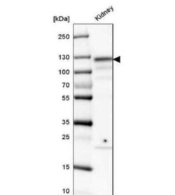 ACE-2 Antibody, Novus Biologicals 0.1 mL | Buy Online | Novus Biologicals | Fisher Scientific