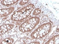 ACE/CD143 Mouse anti-Human, Clone: ACE/3762, Novus Biologicals:Antibodies:Primary