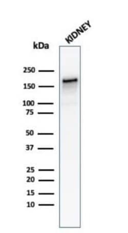 ACE/CD143 Mouse anti-Human, Clone: ACE/3762, Novus Biologicals:Antibodies:Primary
