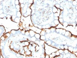 ACE/CD143 Antibody (ACE/3763) - Azide and BSA Free, Novus Biologicals 100 &mu;g | Buy Online | Novus Biologicals | Fisher Scientific
