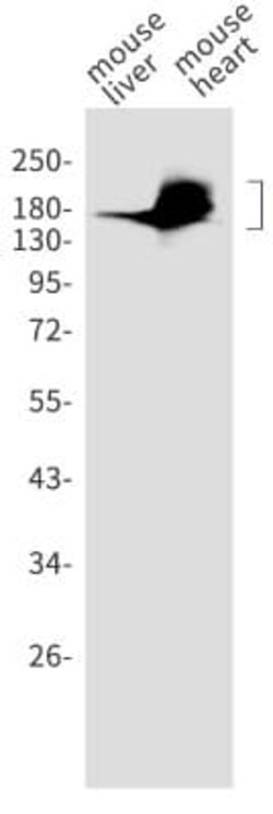 ACE/CD143 Antibody (S01-9E3), Novus Biologicals:Antibodies:Primary Antibodies