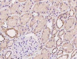 ACN9 Antibody, Novus Biologicals 100 &mu;g; Unconjugated:Antibodies, Polyclonal