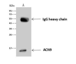 ACN9 Antibody, Novus Biologicals 100 &mu;g; Unconjugated:Antibodies, Polyclonal