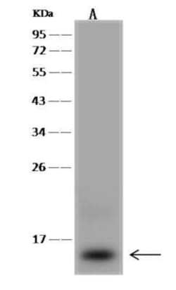 ACN9 Antibody, Novus Biologicals 100 &mu;g; Unconjugated:Antibodies, Polyclonal