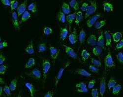 ACOT1 Antibody, Novus Biologicals 100 &mu;g; Unconjugated:Antibodies, Polyclonal