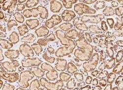 ACOT1 Antibody, Novus Biologicals 100 &mu;g; Unconjugated:Antibodies, Polyclonal
