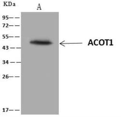 ACOT1 Antibody, Novus Biologicals 100 &mu;g; Unconjugated:Antibodies, Polyclonal