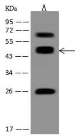 ACOT1 Antibody, Novus Biologicals 100 &mu;g; Unconjugated:Antibodies, Polyclonal