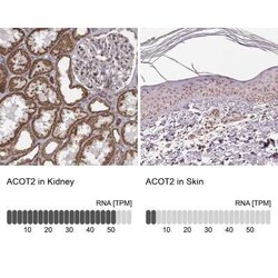 ACOT2 Antibody, Novus Biologicals 100 &mu;g; Unconjugated:Antibodies, Polyclonal
