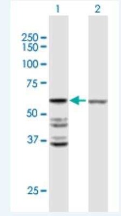 ACOT2 Antibody, Novus Biologicals 50 &mu;g | Buy Online | Novus Biologicals | Fisher Scientific